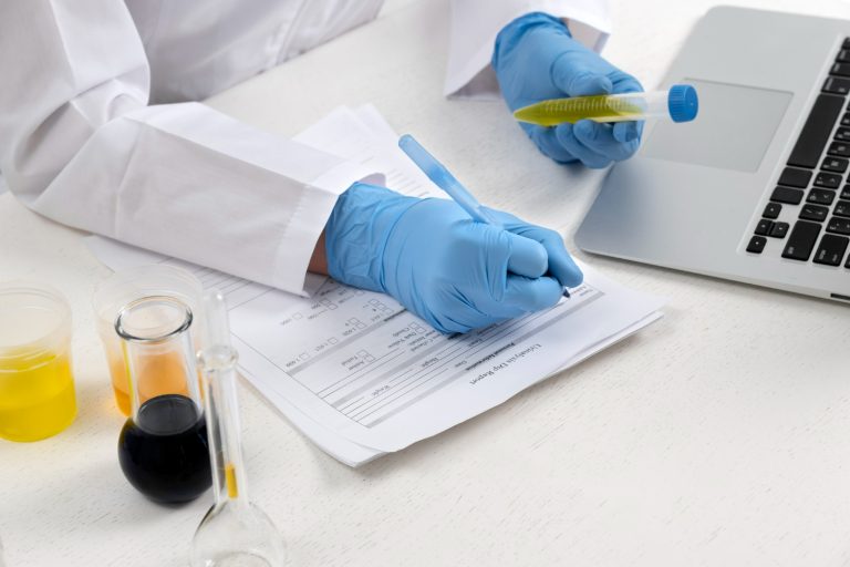 Urine analysis